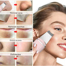 Peeling Esfoliante Ultrassônico Limpeza Facial e Removedor de Cravos