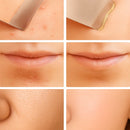 Peeling Esfoliante Ultrassônico Limpeza Facial e Removedor de Cravos